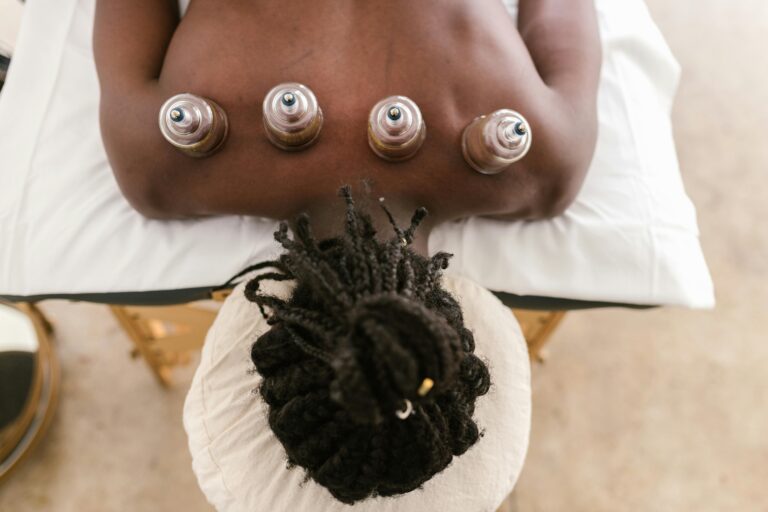 Top view of a cupping therapy session highlighting holistic treatment and relaxation.